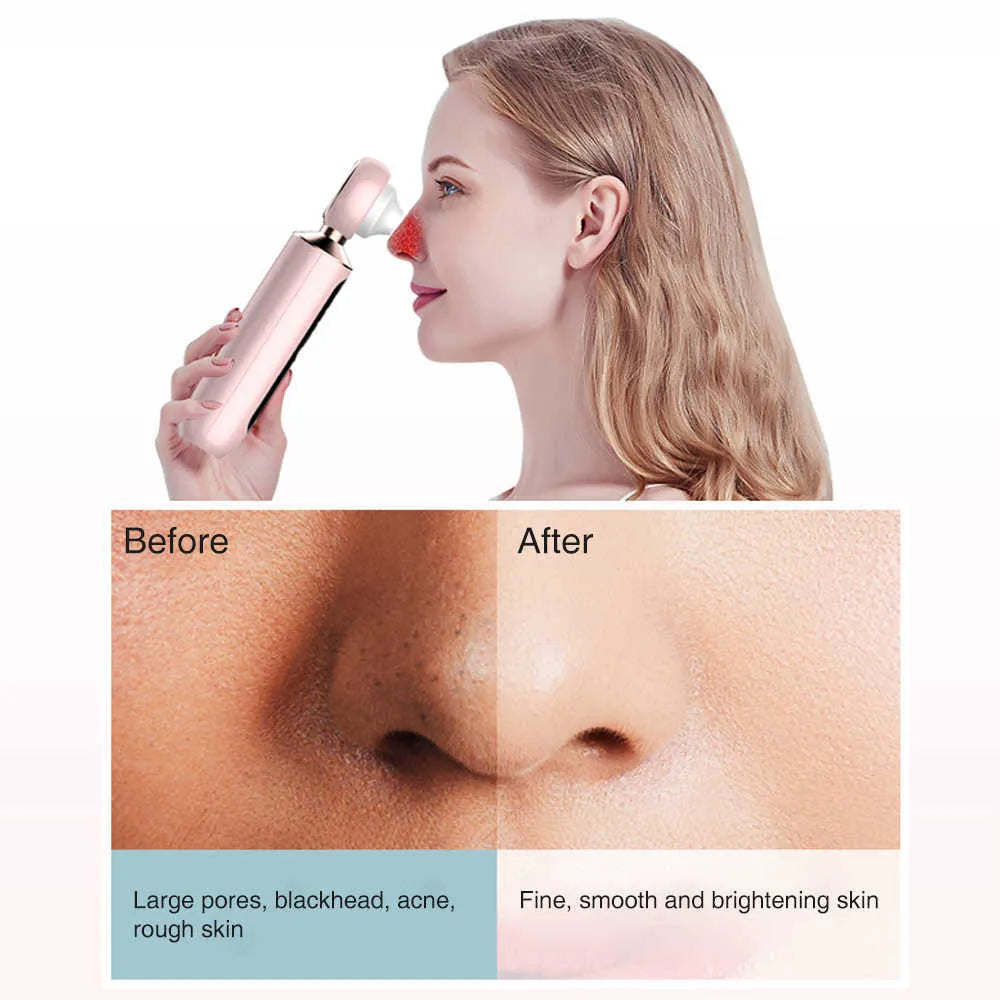 Souq al Masaar™ Blackhead Suction Machine