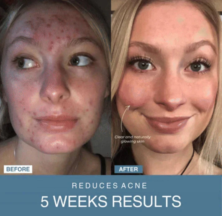 Souq al Masaar™ 7-in-1 LED Anti-Aging/Wrinkle Apparatus