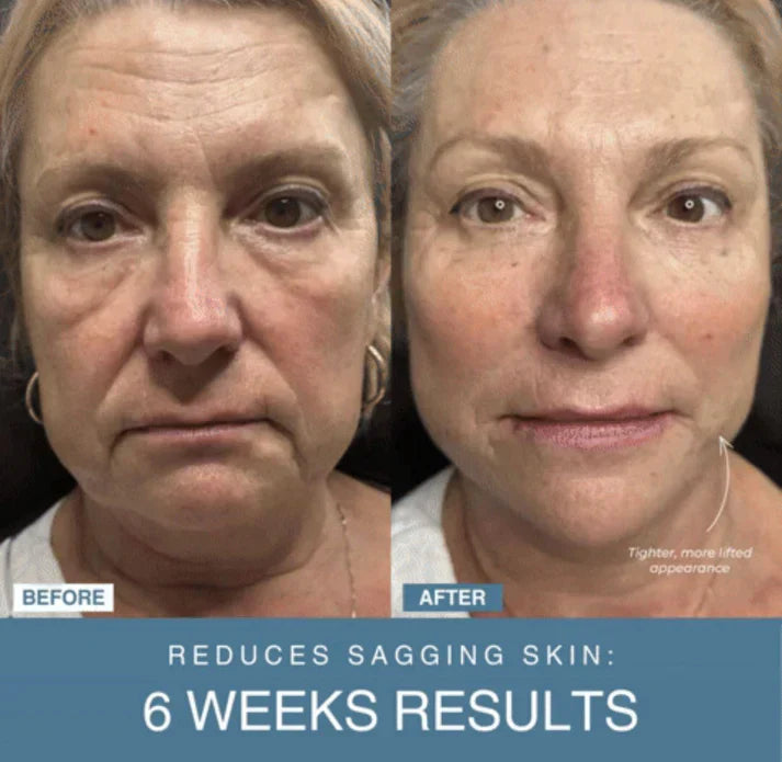Souq al Masaar™ 7-in-1 LED Anti-Aging/Wrinkle Apparatus