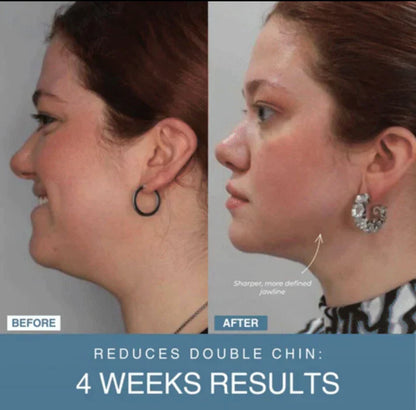 Souq al Masaar™ 7-in-1 LED Anti-Aging/Wrinkle Apparatus